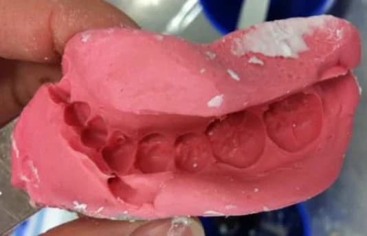 Alginate impression — reference specimen