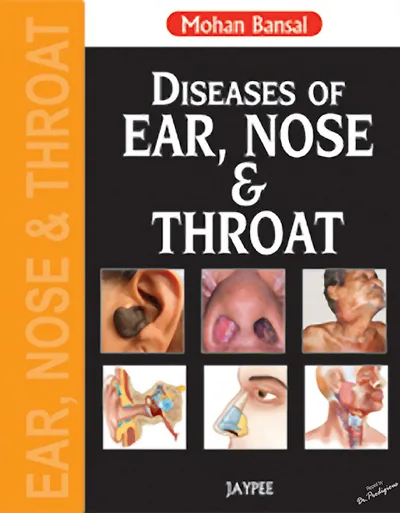 Book cover: Mohan Bansal Diseases of Ear, Nose and Throat 1st
