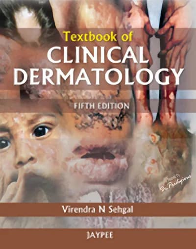 Book cover: VN Shegal Dermatology 5th