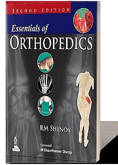 Book cover: Shenoy Essentials of Orthopedics 2nd