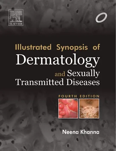 Book cover: Neena Khanna Dermatology 4th