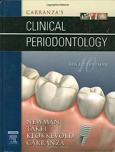 Book cover: CARRANZA - Tenth edition (1)