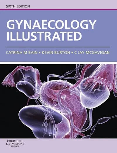 Book cover: Kevin Burton Illustrated Gynaecology 6th