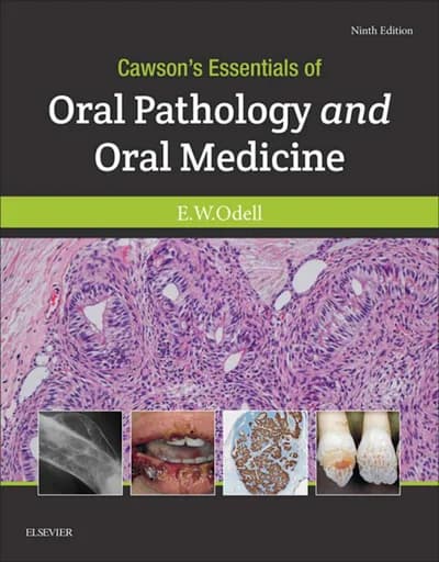 Book cover: Cawson’s Essentials of Oral Pathology and Oral Medicine