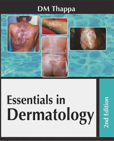 Book cover: DM Thappa Essentials in Dermatology 2nd