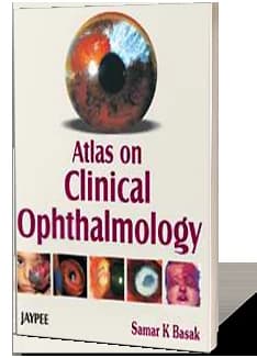 Book cover: Samar K Basak Atlas on Clinical Opthalmology 1st
