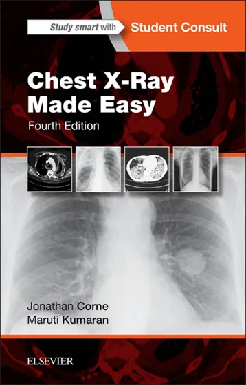 Book cover: Jonathan Corne Chest X-Ray Made Easy 4th