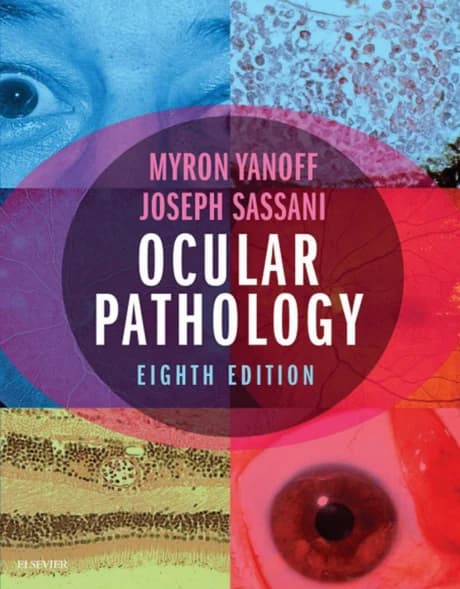 Book cover: Yanoff Ocular Pathology 8th