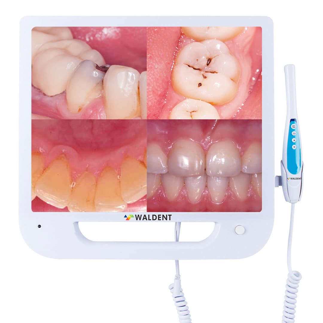 Intraoral Camera - Waldent (With Screen)