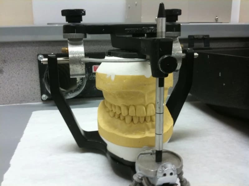 articulator — reference view