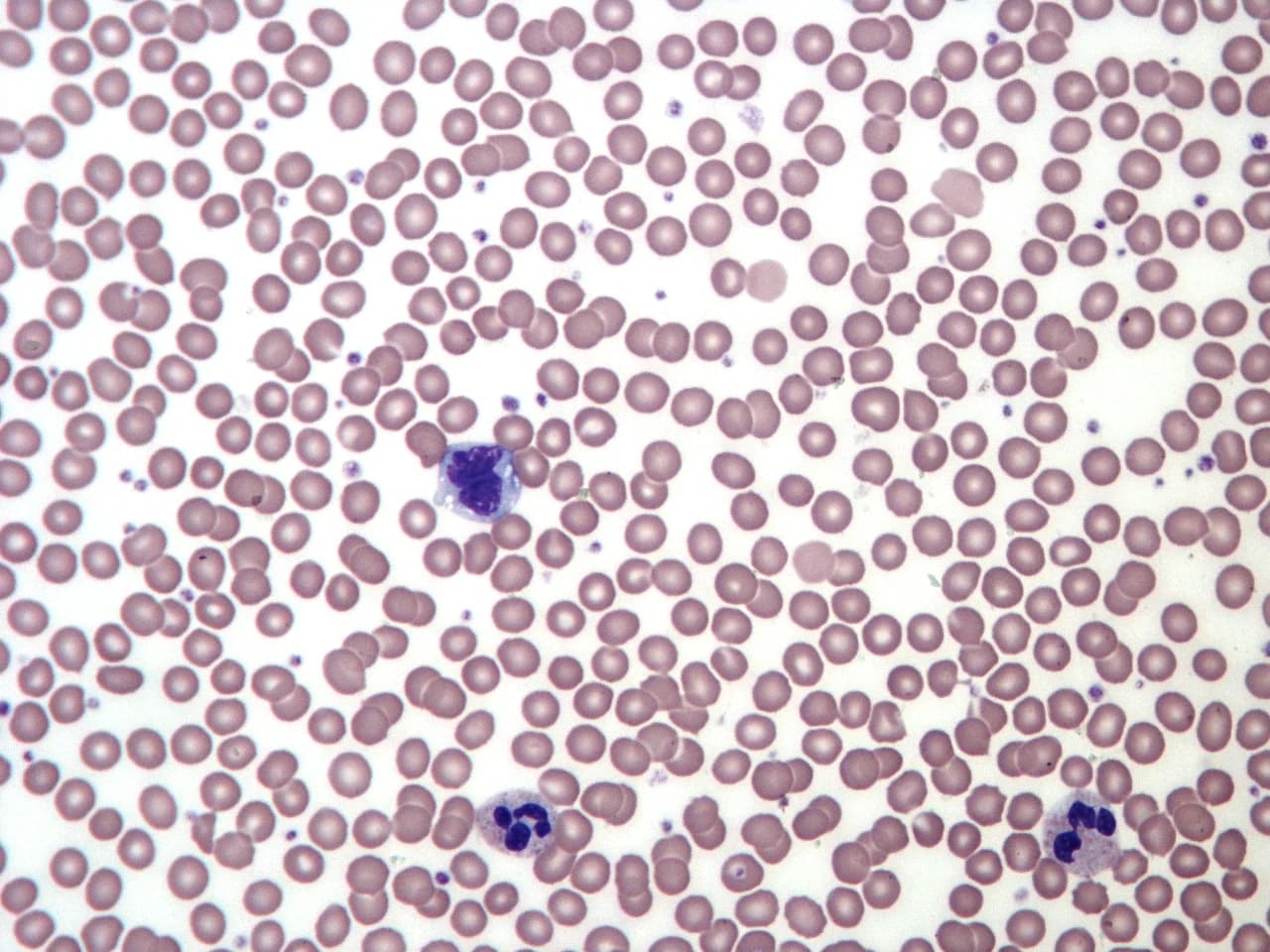 blood smear — reference view