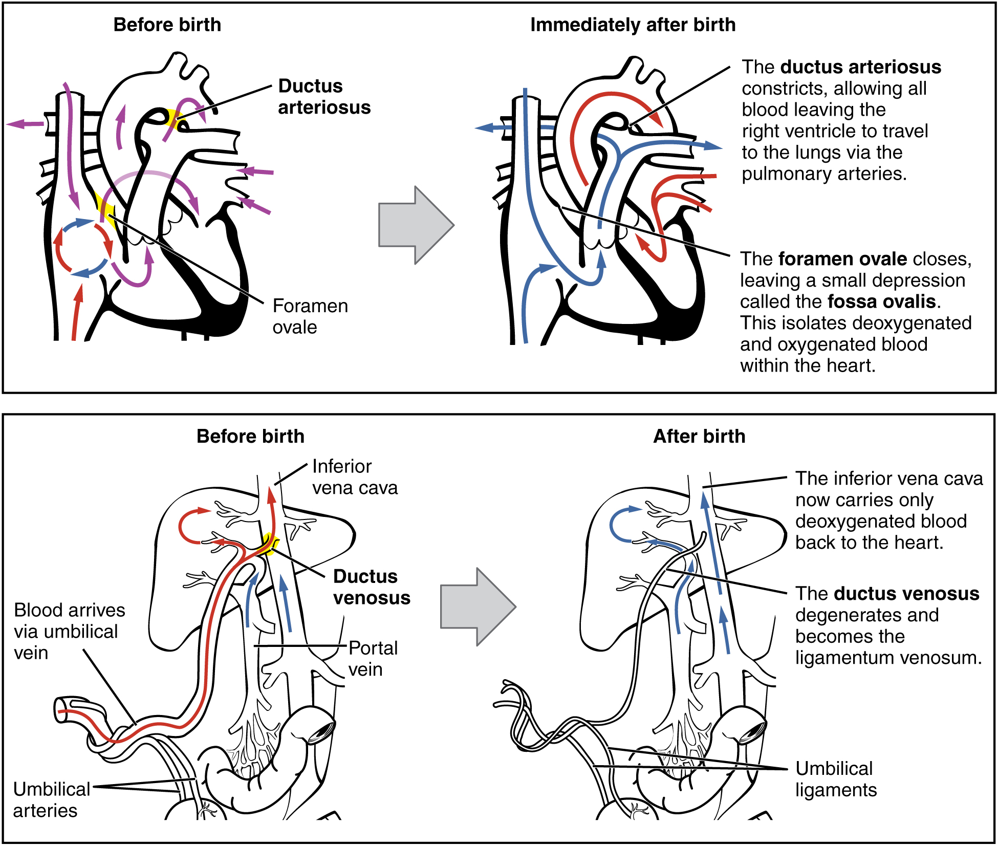 neonatal circulation: labelled anatomical figure. Original source colours and labels retained.
