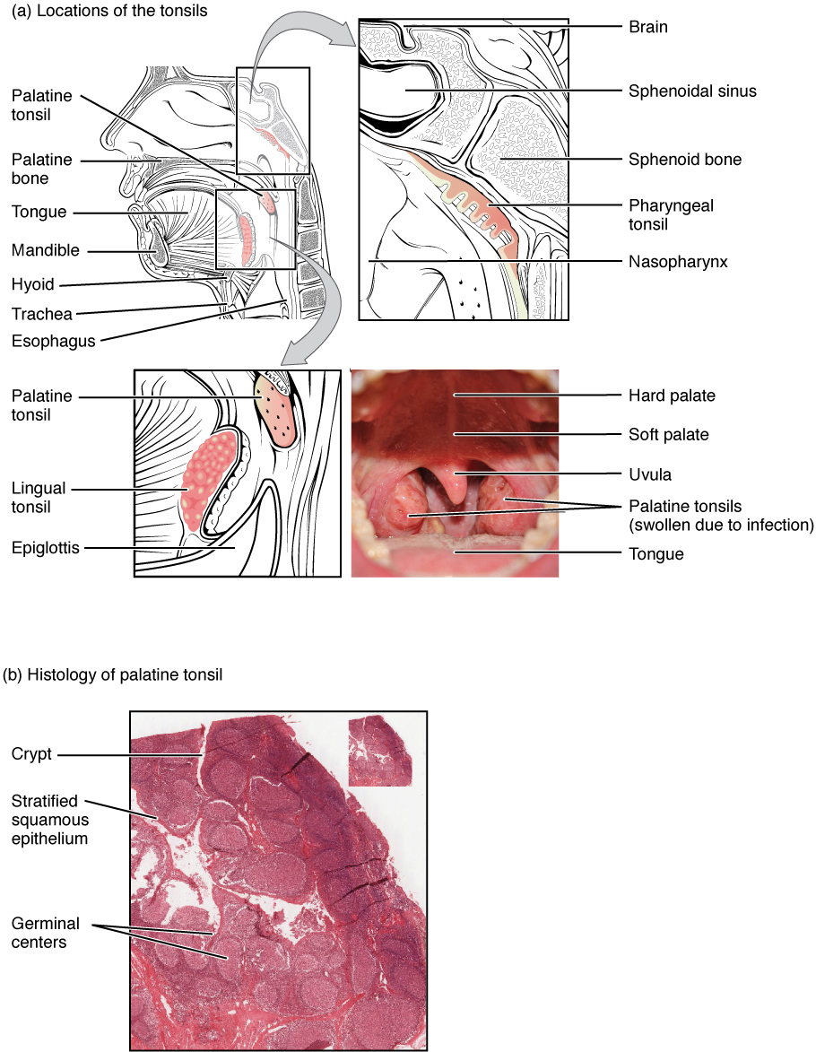 tonsils: labelled anatomical figure. Original source colours and labels retained.