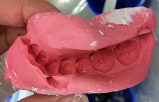 Alginate impression — reference specimen