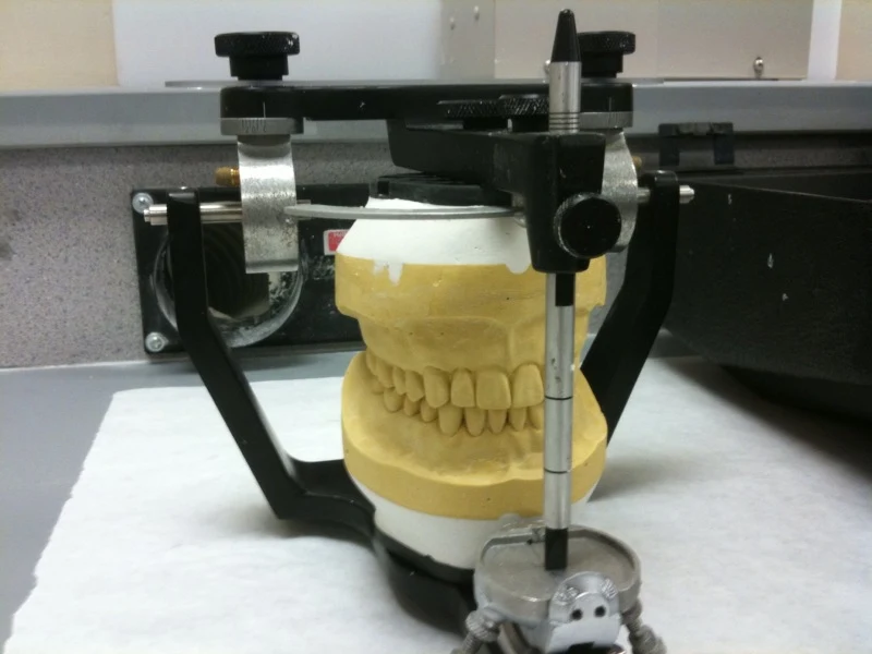articulator — reference view