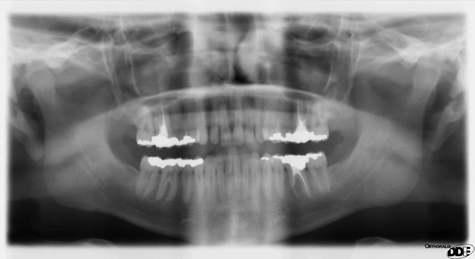 panoramic radiograph — reference view