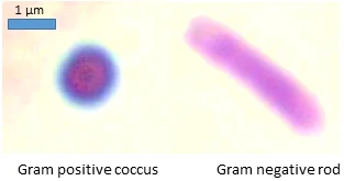 gram stain — reference view