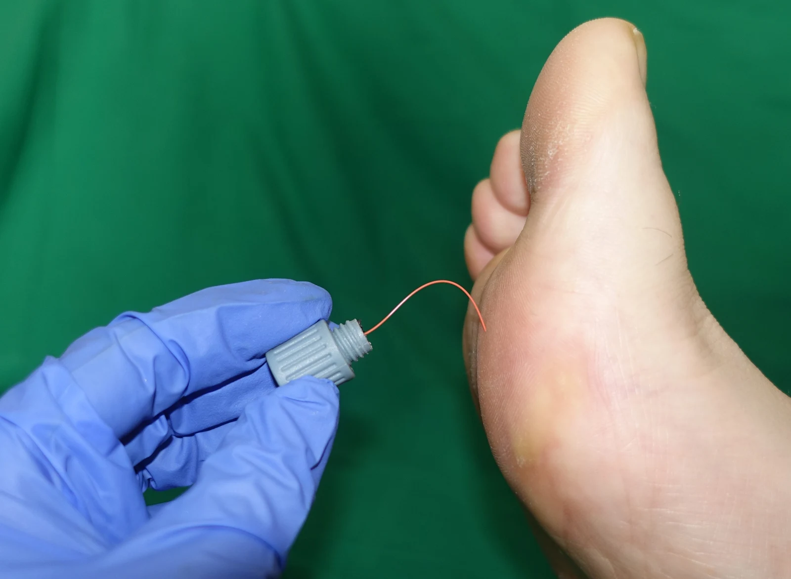 Semmes–Weinstein monofilament — reference view